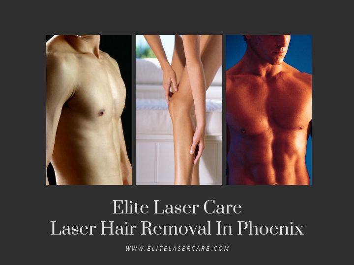 Comprehensive Guide to Laser Hair Removal in Scottsdale: What to Expect and How to Prepare