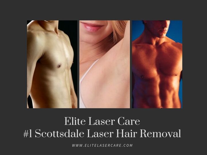 Crafting a Clear and Effective Scope for Laser Hair Removal in Scottsdale: Avoiding Misunderstandings from Start to Finish
